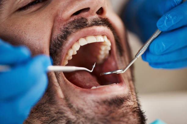 Best Pediatric Emergency Dentist in Cresskill, NJ