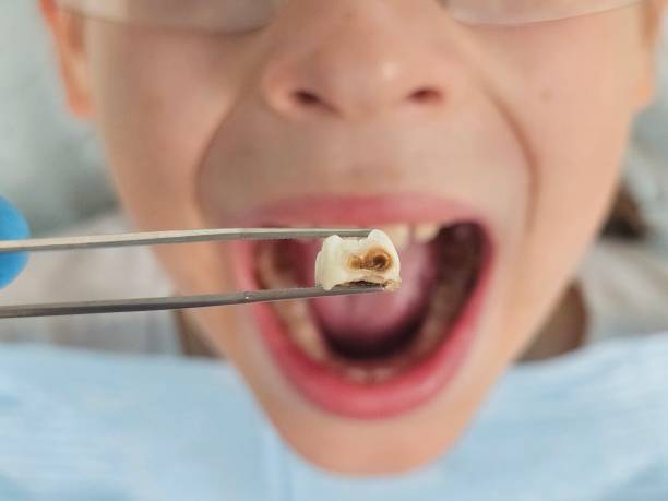 Best Emergency Gum Treatment in Cresskill, NJ